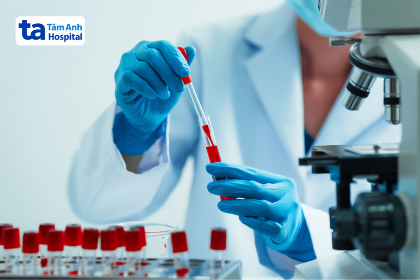 kết quả xét nghiệm