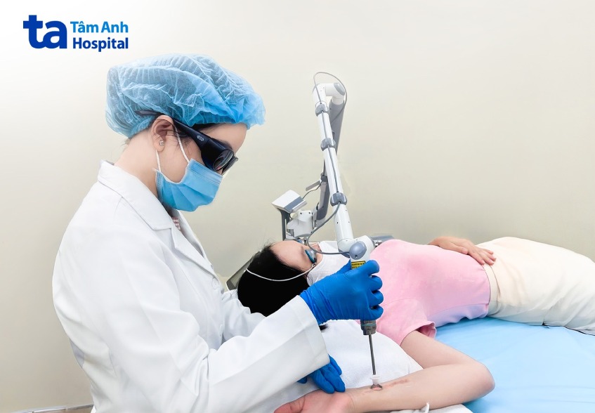 khách hàng đang xóa xăm