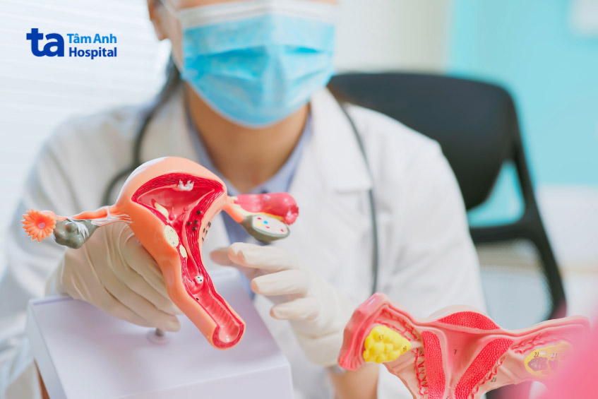 Chị em phụ nữ nên khám phụ khoa định kỳ hoặc khám ngay khi có dấu hiệu bất thường để phát hiện sớm các vấn đề nếu có, giúp bảo vệ sức khỏe và khả năng sinh sản