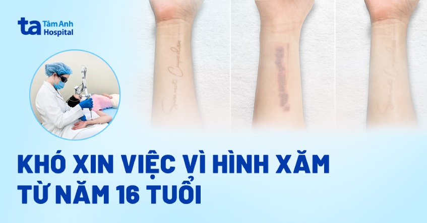 Khó xin việc vì hình xăm từ năm 16 tuổi