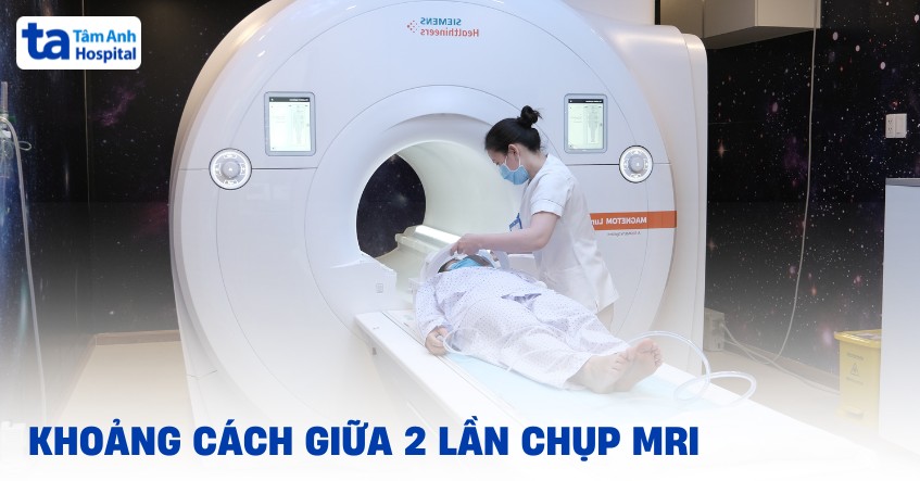 Khoảng cách giữa 2 lần chụp MRI là bao lâu? Khi nào nên chụp lại?