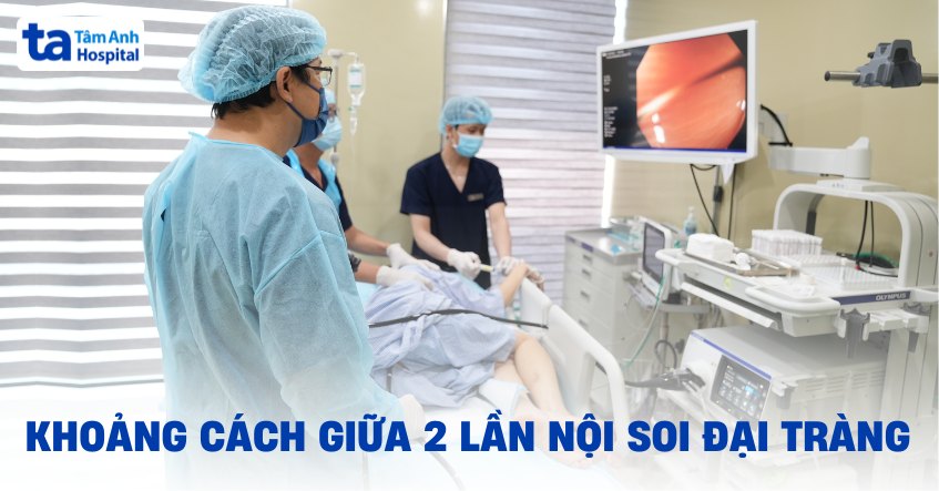 Khoảng cách giữa 2 lần nội soi đại tràng kéo dài bao lâu?