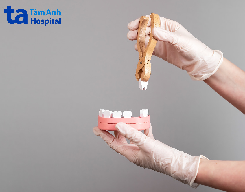 Phương pháp điều trị khớp cắn chéo