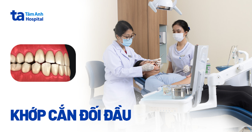 Khớp cắn đối đầu (đỉnh): Nguyên nhân, cách nhận biết và xử lý