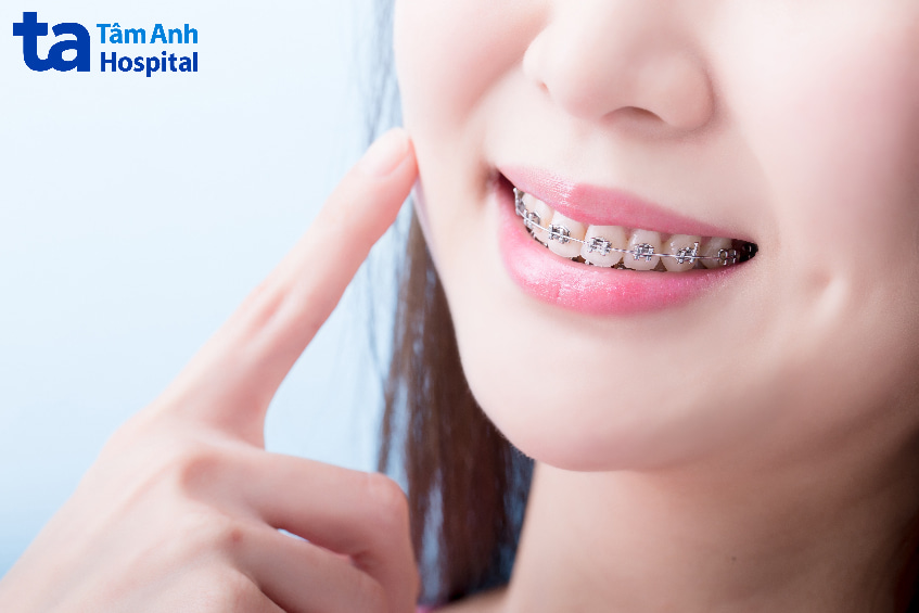 Phương pháp điều trị răng đối đỉnh