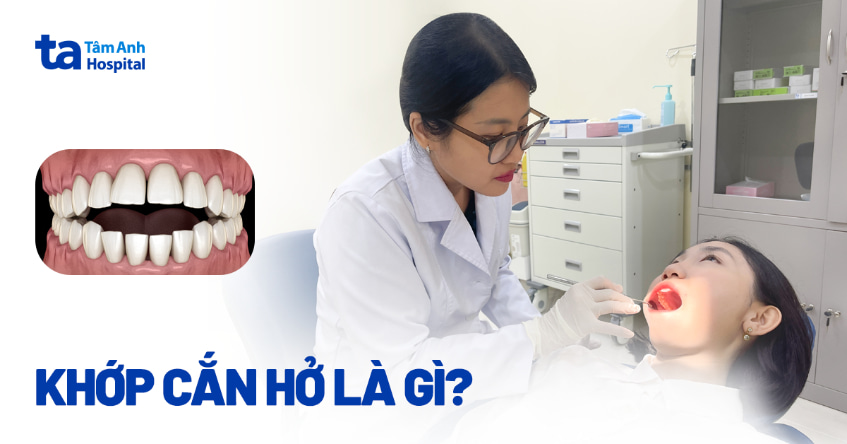 Khớp cắn hở là gì? Nguyên nhân, cách nhận biết và điều trị