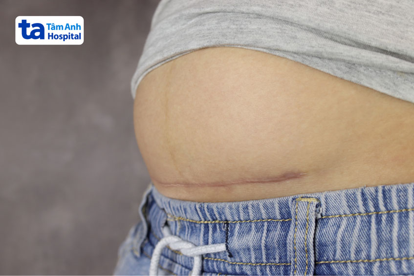 khuyến nghị của chuyên gia