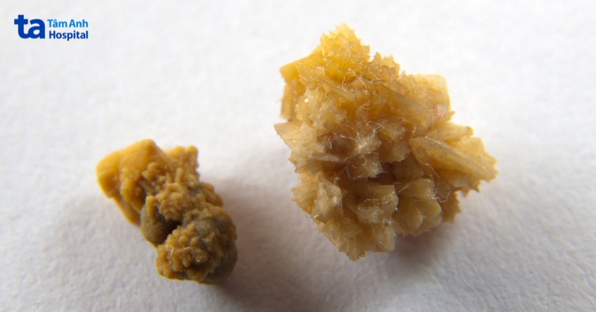 kích thước sỏi san hô