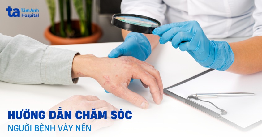 Lập kế hoạch chăm sóc bệnh nhân vảy nến tại nhà: Hướng dẫn chi tiết