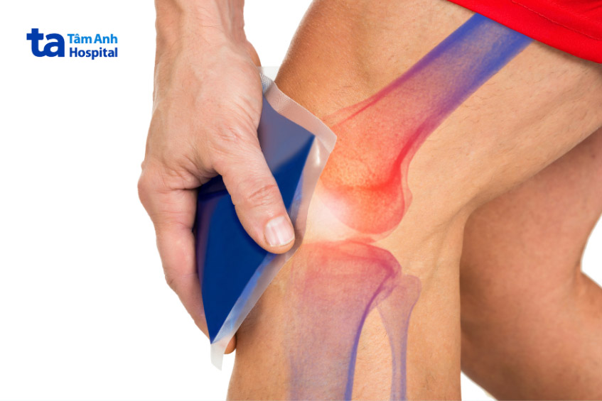 Liệu pháp nhiệt cải thiện tràn dịch khớp gối