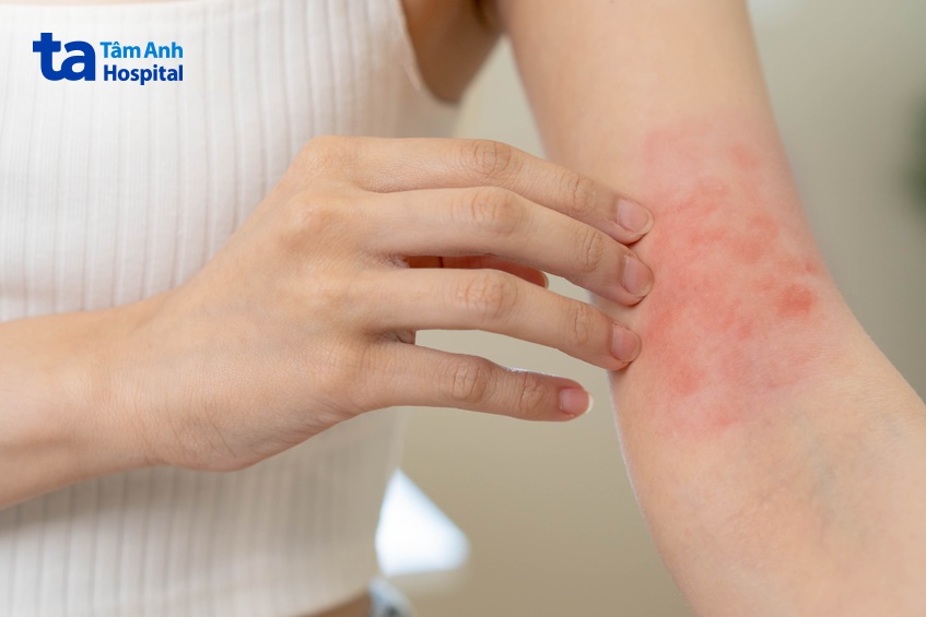 lưu ý khi sử dụng thuốc kháng sinh điều trị tràn dịch màng phổi