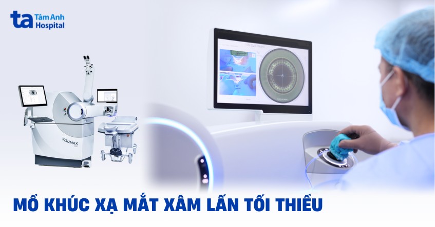Mổ khúc xạ mắt xâm lấn tối thiểu: Chỉ định và quy trình phẫu thuật
