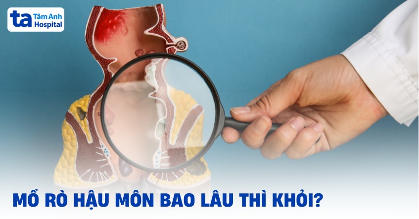 ​Mổ rò hậu môn bao lâu thì khỏi​? Thời gian phục hồi thế nào?