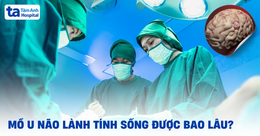 Mổ u não lành tính sống được bao lâu? Tiên lượng như thế nào?
