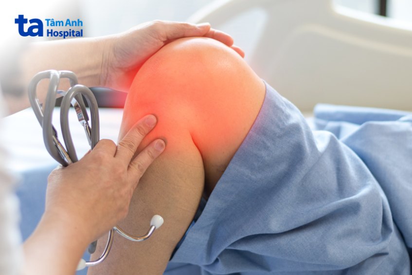 Mức độ tổn thương khớp gối