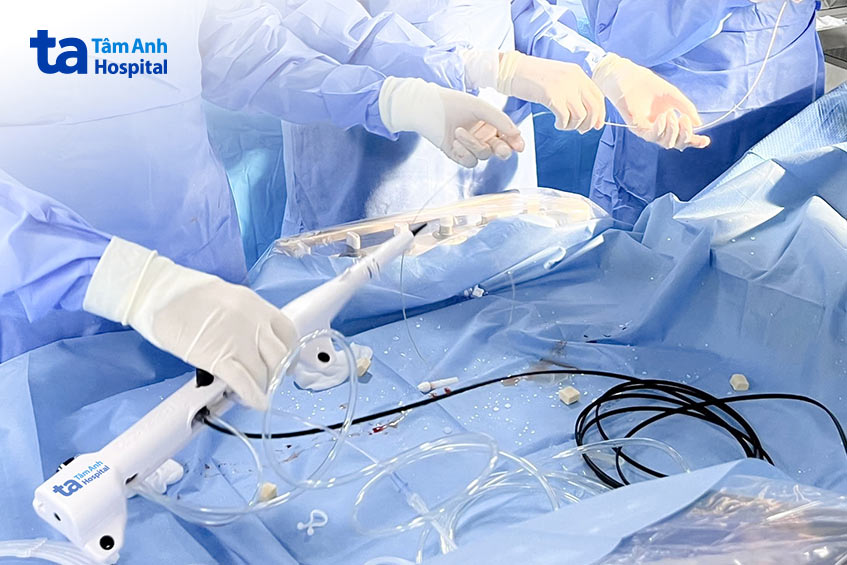 Mũi khoan kim cương Rotablator xuyên thủng mảng vôi hóa trong lòng mạch vành