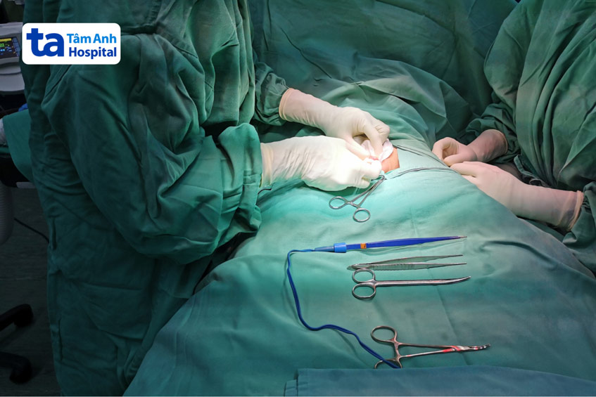 Nam giới nên lựa chọn bệnh viện cắt bao quy đầu uy tín để đảm bảo thủ thuật diễn ra suôn sẻ