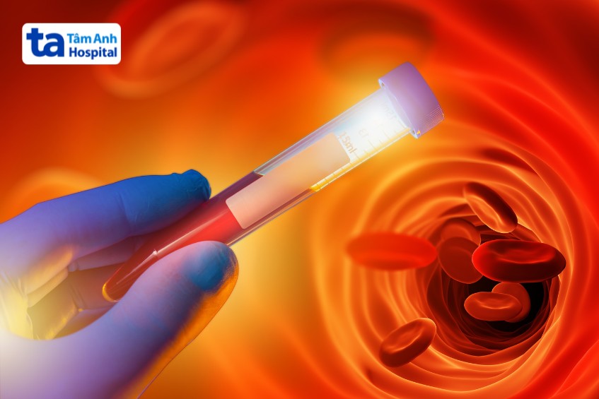 nên nhịn ăn trước khi xét nghiệm máu