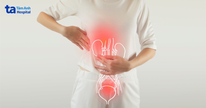 nguy cơ mắc sỏi san hô