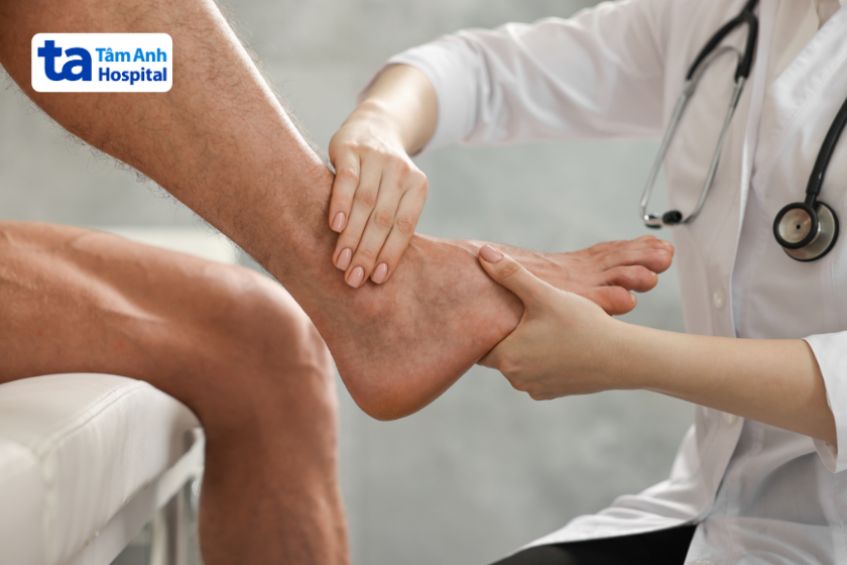 Nguy cơ mắc u bao hoạt dịch cổ chân
