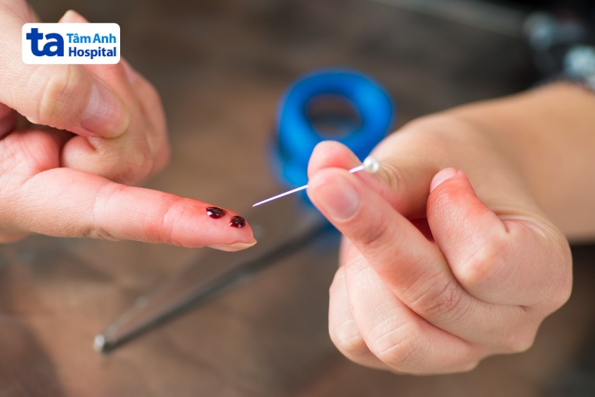 nguy hiểm khi sơ cứu đột quỵ bằng kim