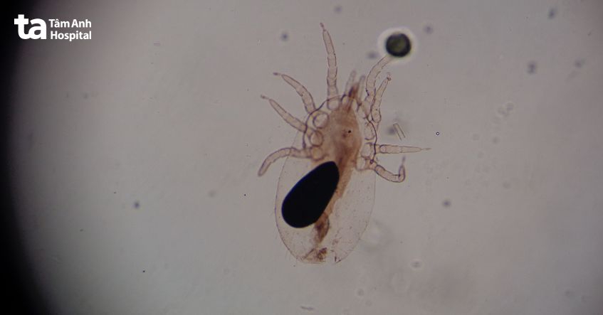 nguyên nhân gây ghẻ ruồi