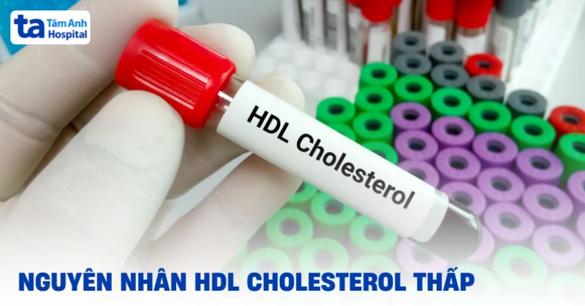 8 nguyên nhân HDL cholesterol thấp phổ biến và cách cải thiện