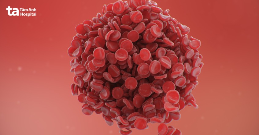 Huyết khối tĩnh mạch thận - cục máu đông trong tĩnh mạch thận có thể dẫn đến tình trạng huyết áp này