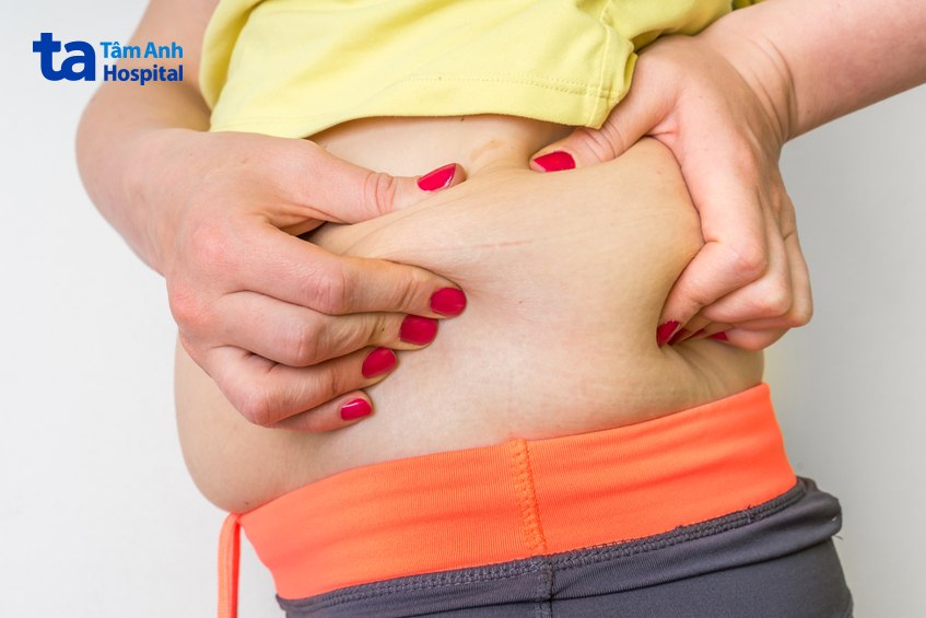 nhiều nguyên nhân tích mỡ 2 bên hông
