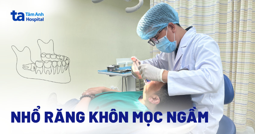 Nhổ răng khôn mọc ngầm: Khi nào cần và có nguy hiểm không?