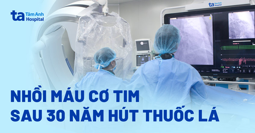 Nhồi máu cơ tim sau 30 năm hút thuốc lá