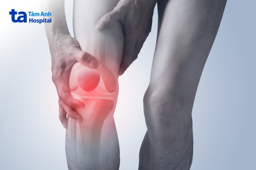 Những điều cần biết về cứng khớp gối