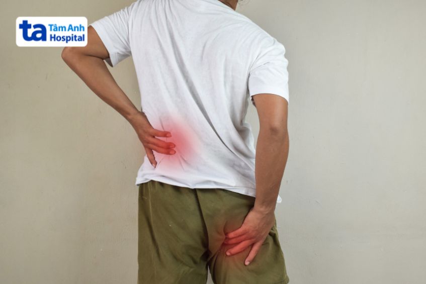 Những điều cần biết về đau thần kinh tọa