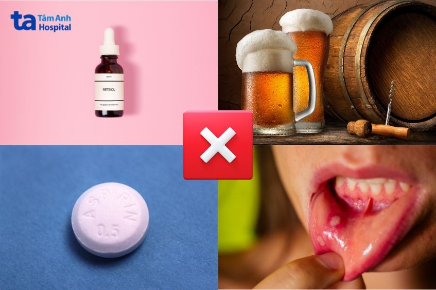 những điều cần tránh trước và sau khi thực hiện