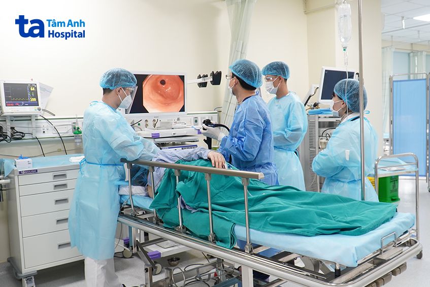 nội soi dạ dày để phát hiện ung thư