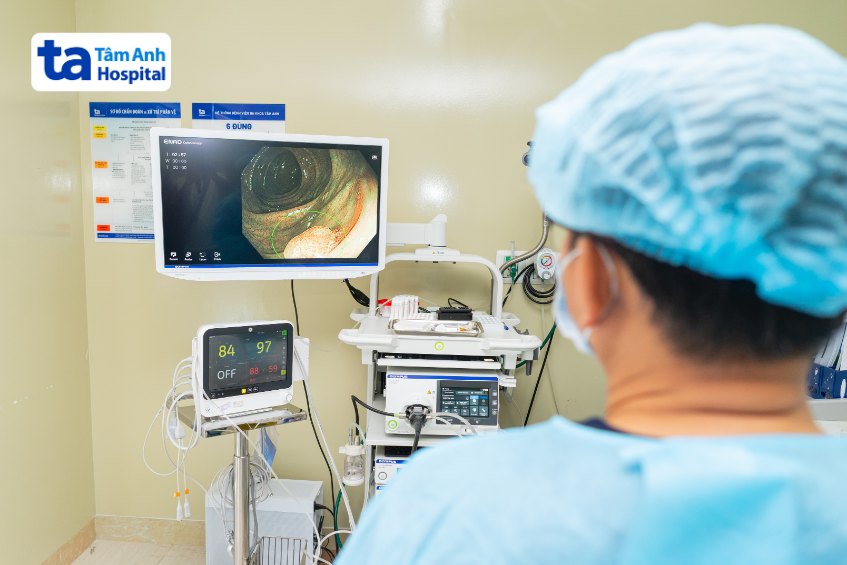 nội soi đại tràng có gây mê
