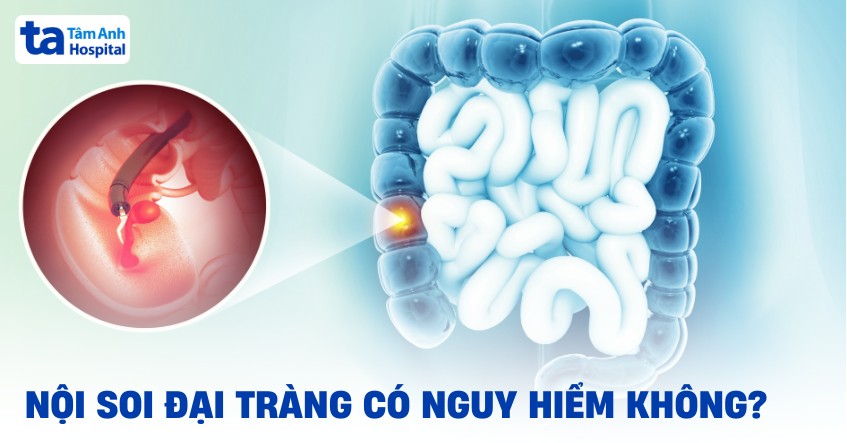 Nội soi đại tràng có nguy hiểm không? 4 biến chứng có thể gặp