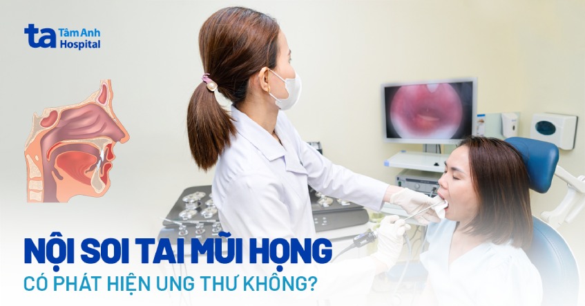 Nội soi tai mũi họng có phát hiện ung thư không? Hiệu quả không?