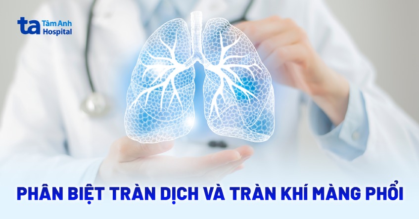 Phân biệt tràn dịch và tràn khí màng phổi: Giống và khác nhau thế nào?