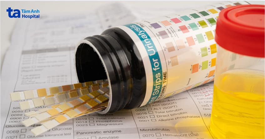 phân tích nước tiểu để chẩn đoán nguyên nhân