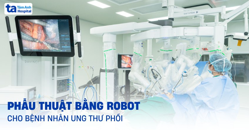 Phẫu thuật bằng robot cho bệnh nhân ung thư phổi