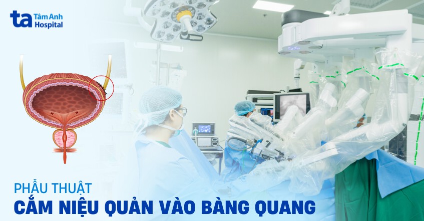 phẫu thuật cắm niệu quản vào bàng quang