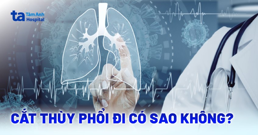 phẫu thuật cắt thùy phổi đi có sao không