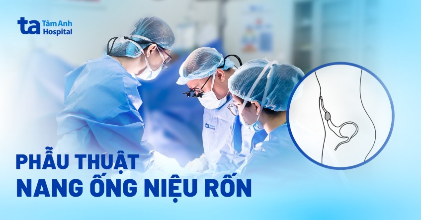 Phẫu thuật nang ống niệu rốn ở trẻ sơ sinh khi nào nên thực hiện?