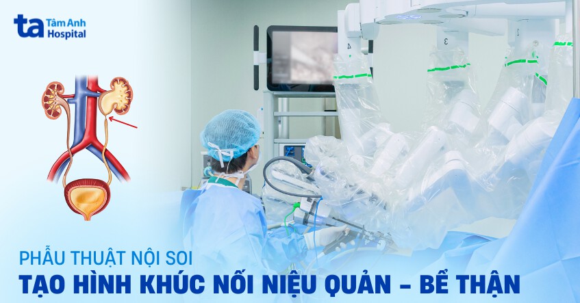 Phẫu thuật nội soi tạo hình khúc nối niệu quản bể thận như thế nào?