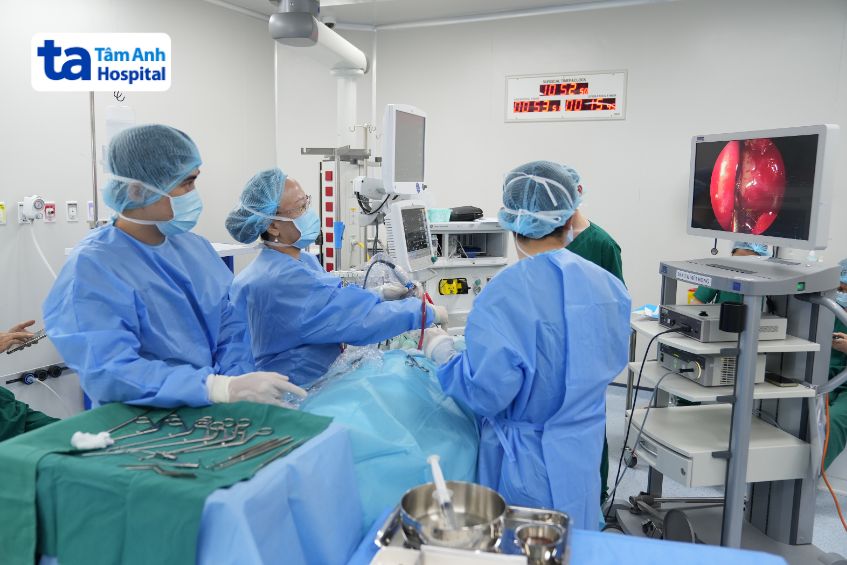 phẫu thuật nội soi viêm xoang hàm