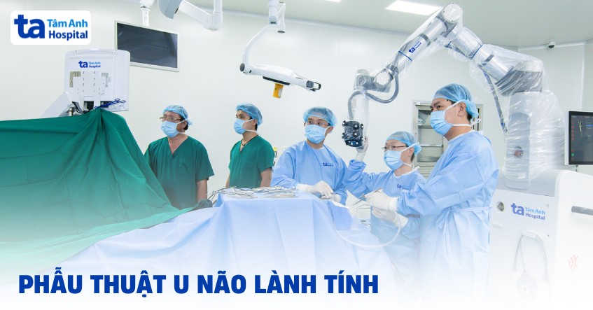 3 phương pháp phẫu thuật u não lành tính hiện đại, hiệu quả