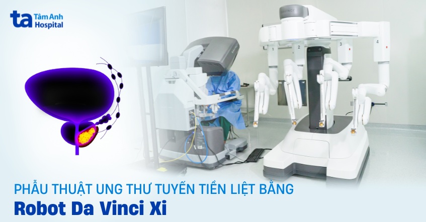 Phẫu thuật ung thư tuyến tiền liệt bằng robot Da Vinci Xi hiện đại