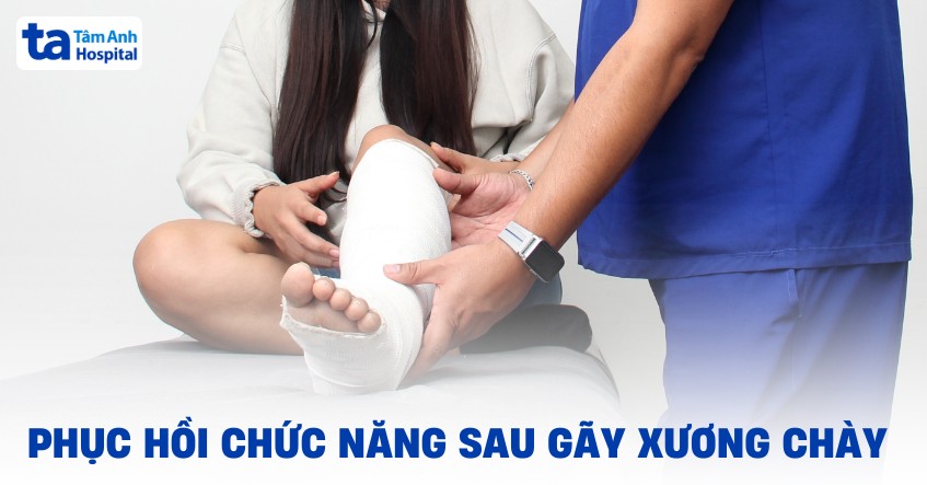 8 bài tập phục hồi chức năng sau gãy xương chày giúp nhanh hồi phục