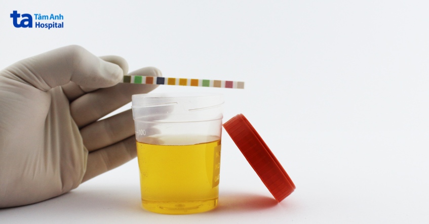 phương pháp chẩn đoán sỏi niệu đạo